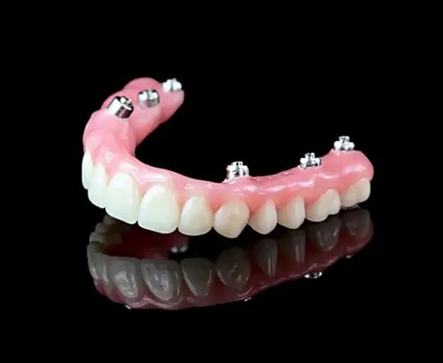 Rediscover Confidence and Comfort with Dentures at Gracious&nbsp;Smiles