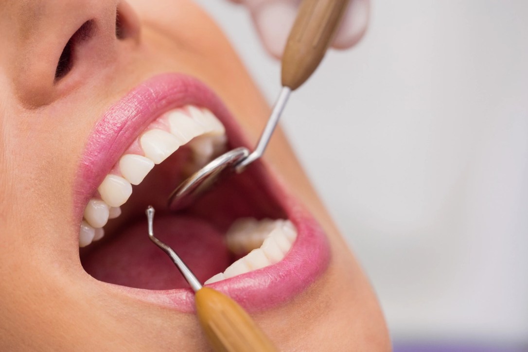 Achieving Healthy Gums: Your Guide to Gum&nbsp;Health